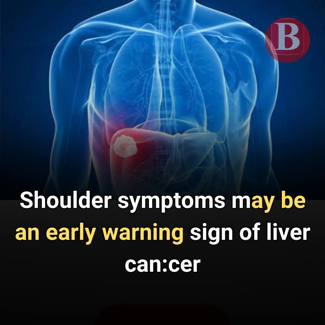 Shoulder Symptoms May Be an Early Warning Sign of Liver Ca.ncer