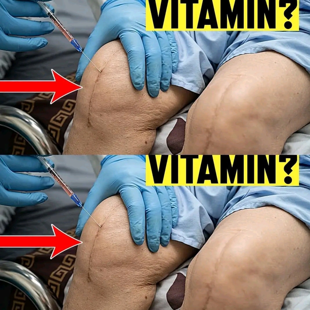 The Most Powerful Vitamins That Will Save Your Knees from Surgery!