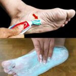 Benefits of Using Toothpaste on Your Feet
